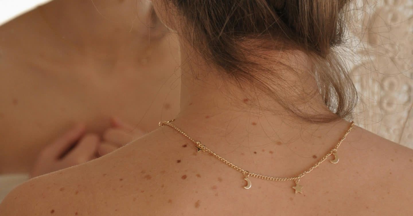 Close-up of a woman's upper back and neck showing multiple brown birthmarks with a gold moon and star necklace
