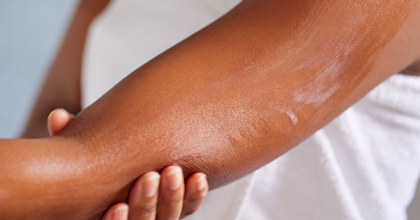 Close-up of a person rubbing moisturiser onto their forearm, showing sun damage on brown skin