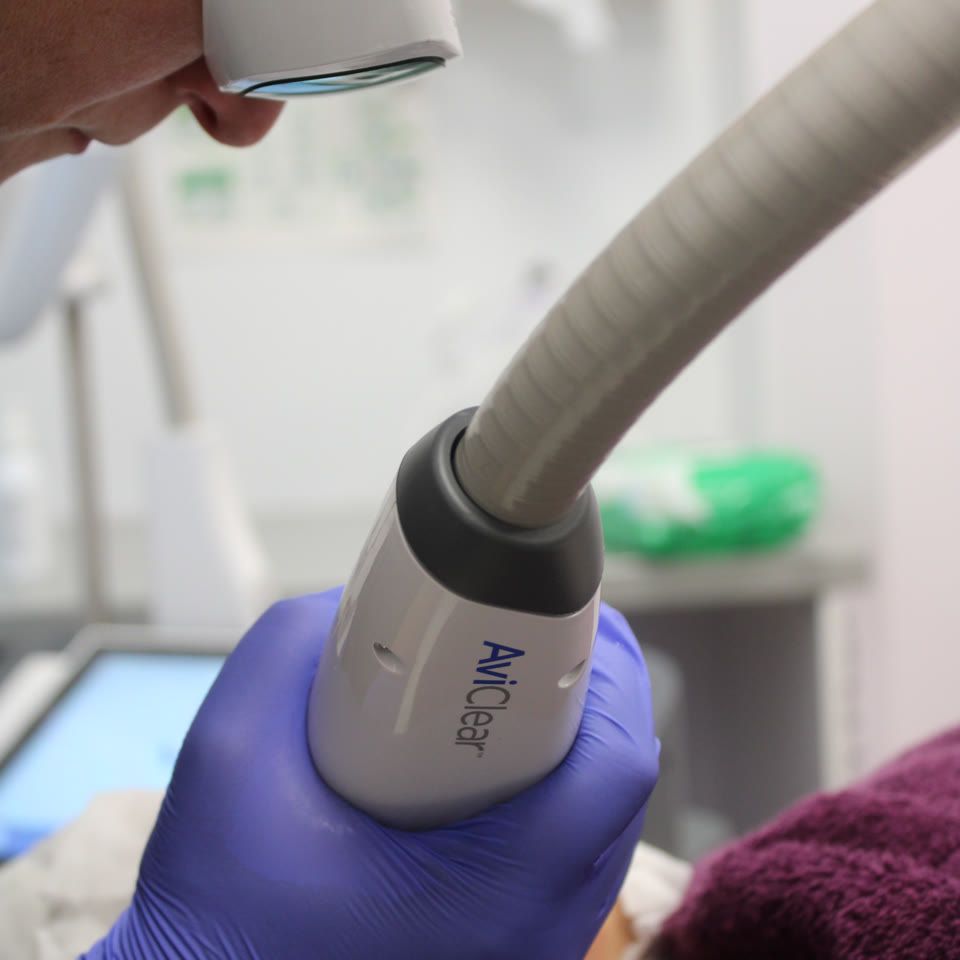 Clinician wearing protective goggles and blue gloves holding an AviClear laser handpiece during a skin treatment