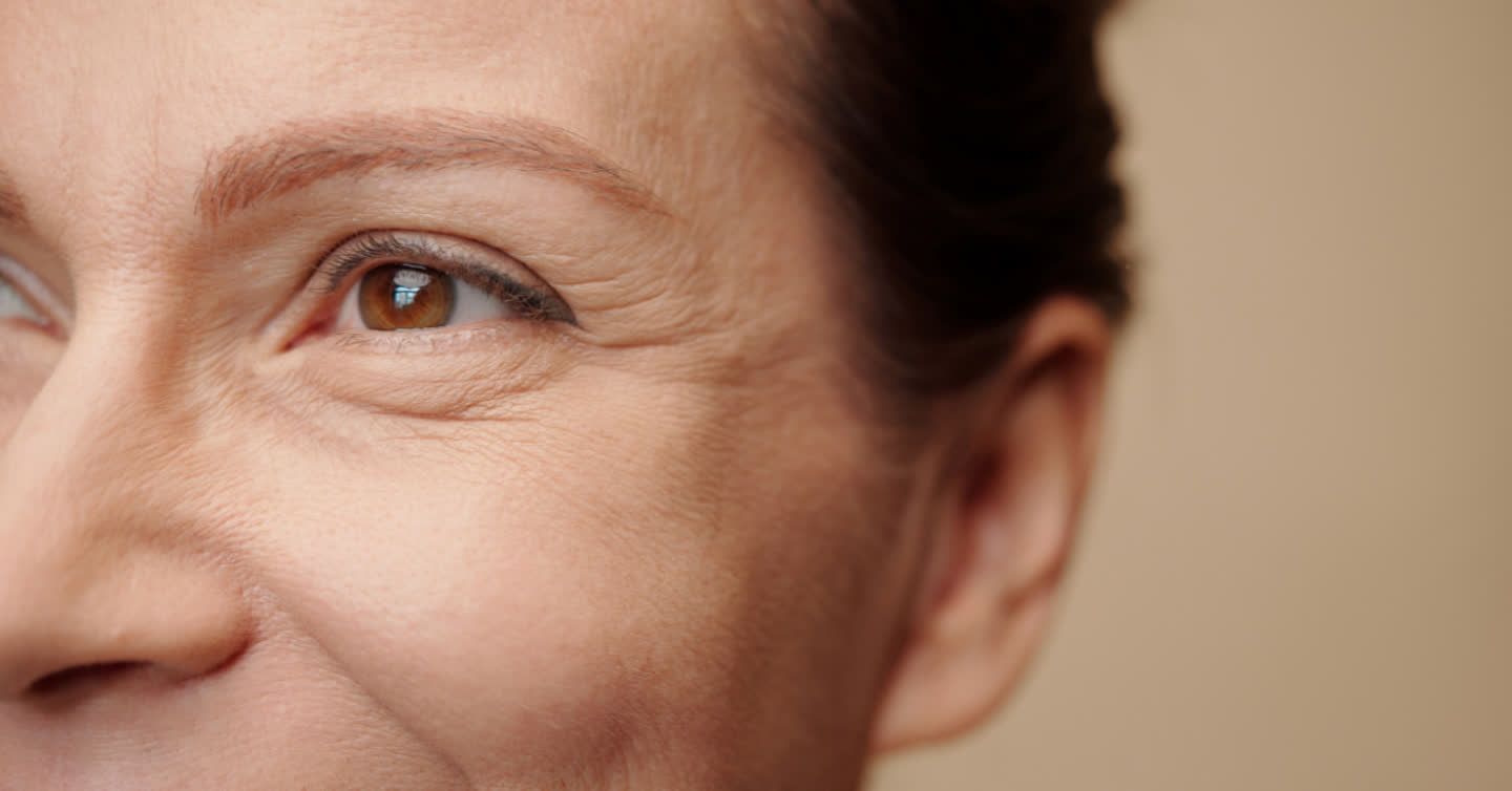 Close-up of a mature woman's face showing fine lines and wrinkles around her brown eye, suitable for EndyMed treatments