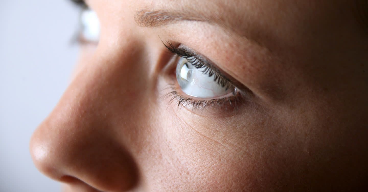 Close-up of a woman's eye and surrounding skin showing visible dark circles and fine lines beneath the eye