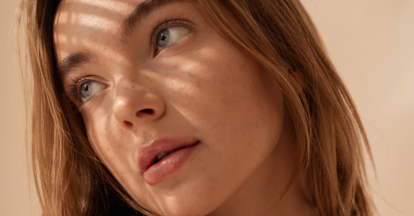 Close-up of a woman with blue eyes and light brown hair showing uneven skin pigmentation across her cheeks in natural light