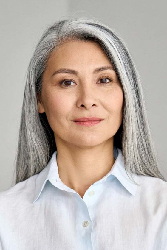 Facial Fat Transfer