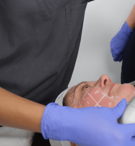 What Is HiFu? The Non-Surgical Facelift Revolution Explained