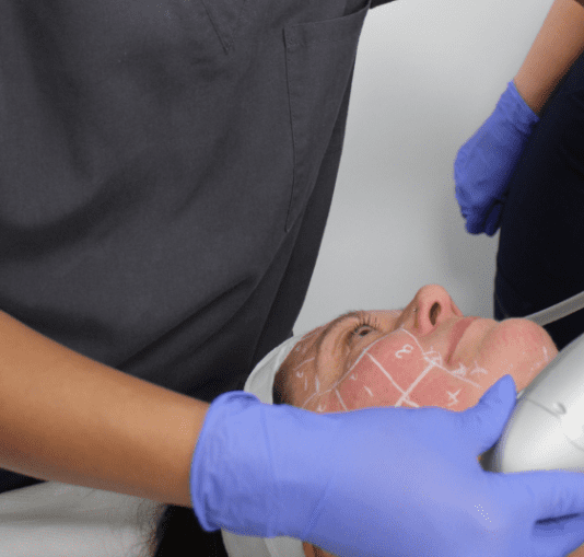 What Is HiFu? The Non-Surgical Facelift Revolution Explained