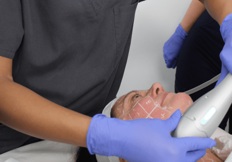 What Is HiFu? The Non-Surgical Facelift Revolution Explained
