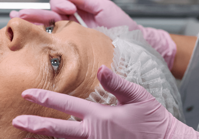 Can Skin Tightening Delay the Need for a Facelift?