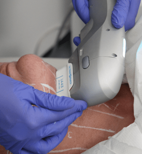 Is HiFu Safe? Side Effects, Downtime, and What to Expect