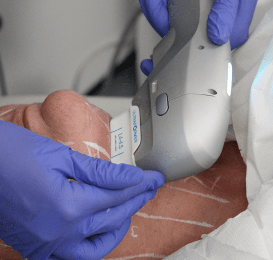 Is HiFu Safe? Side Effects, Downtime, and What to Expect